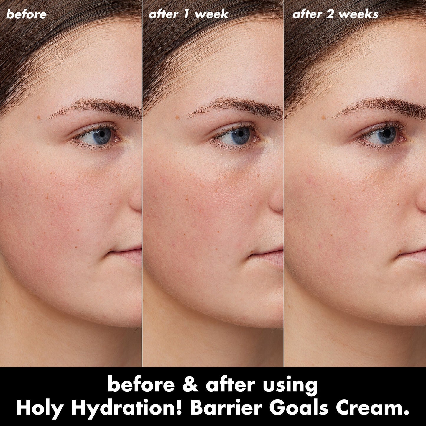holy-hydration-barrier-goals-cream-q9 0226_EDU_HHBarrierGoalsCream_B_A_Zoe_TRYPTICH_710f5249-3a6b-41fd-89e4-817294dd9258.jpg