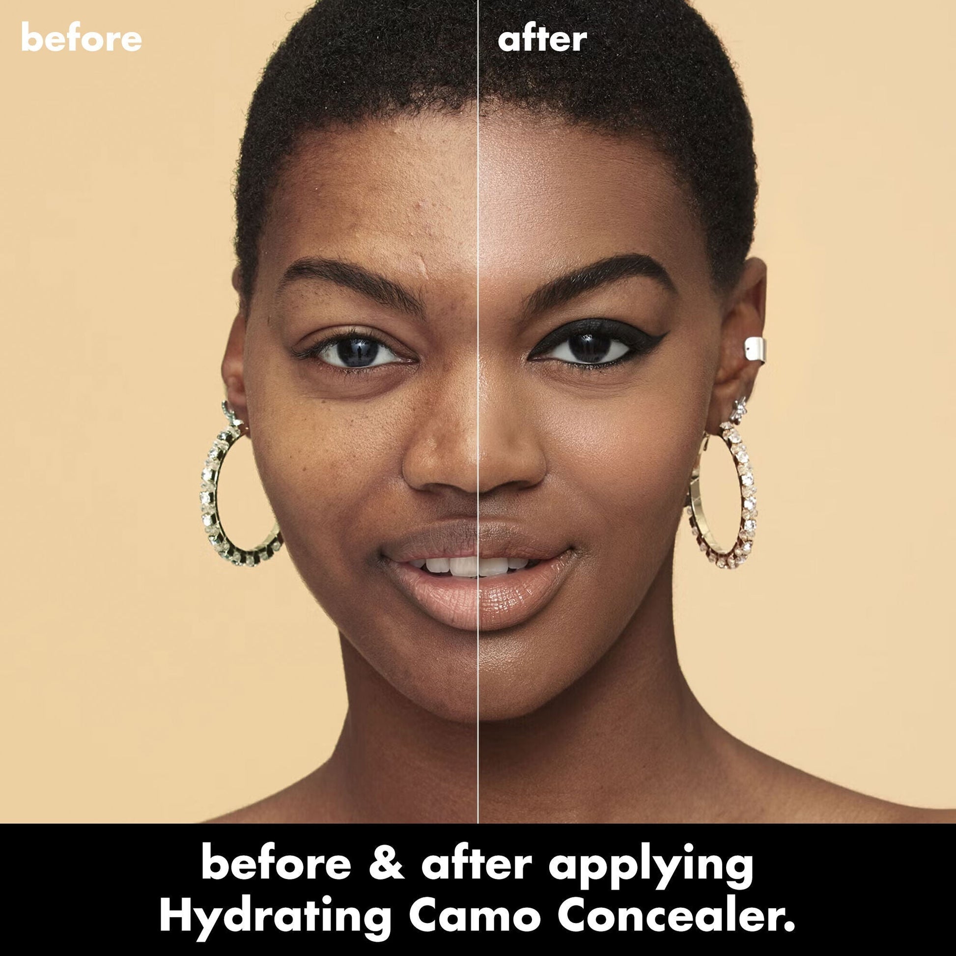 hydrating-camo-concealer-q2 0226_EDU_HydratingCamoConcelaer_BA_AshleyKaresh_20_1_d8499bbf-0e91-4173-b5e2-75127caf83a3.jpg