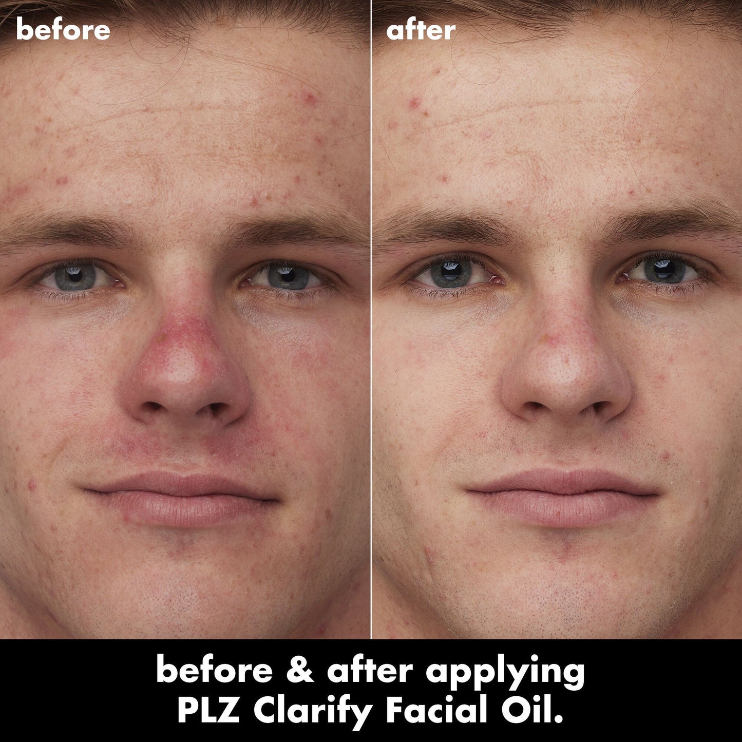 plz-clarify-facial-oil-k6 0326_EDU_PlzClarify_BA_Caleb.jpg