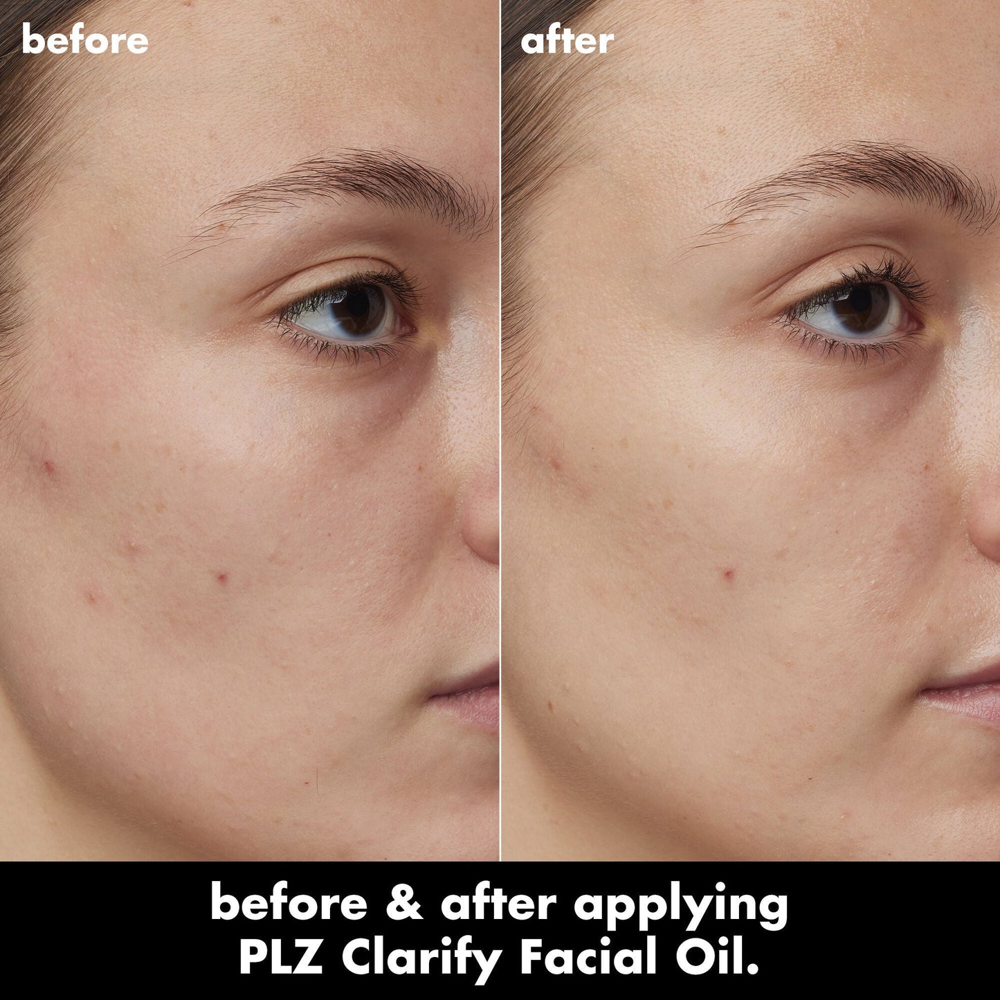 plz-clarify-facial-oil-k6 0326_EDU_PlzClarify_BA_Kelly.jpg