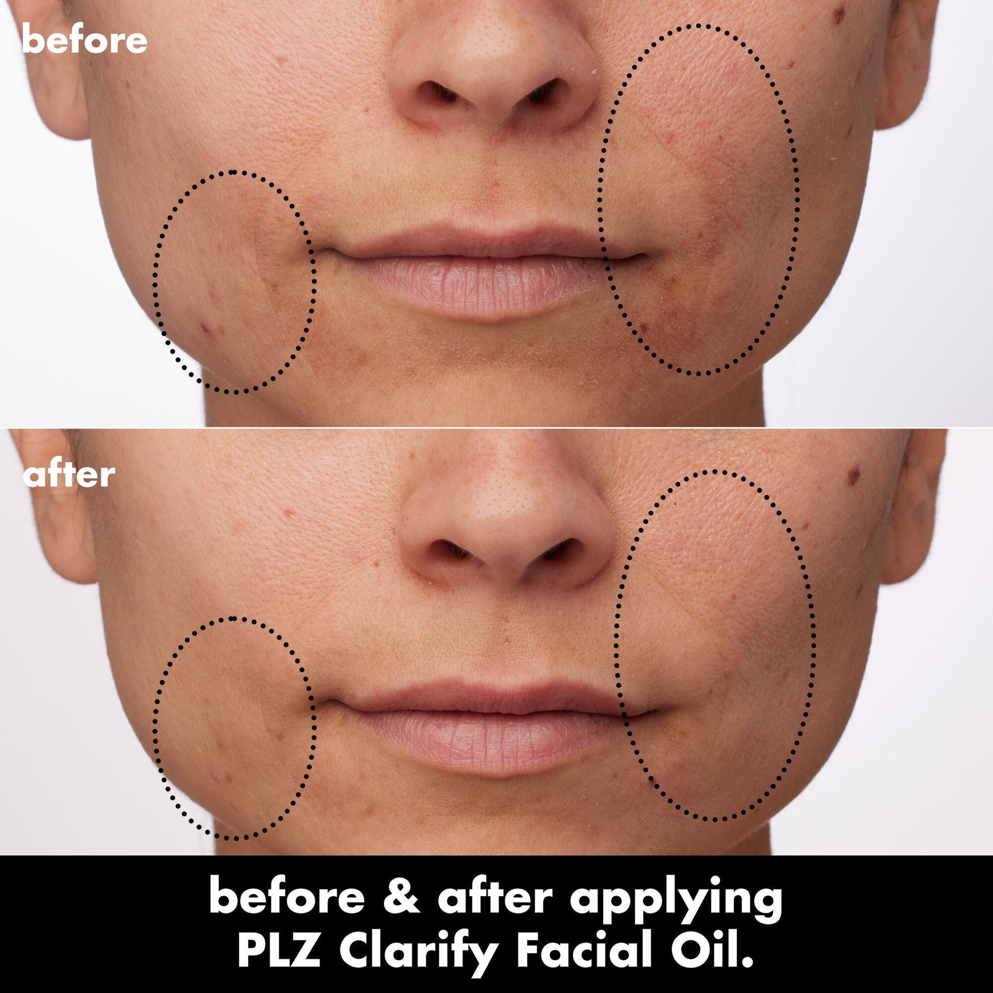 plz-clarify-facial-oil-k6 0326_EDU_PlzClarify_BA_Paula.jpg