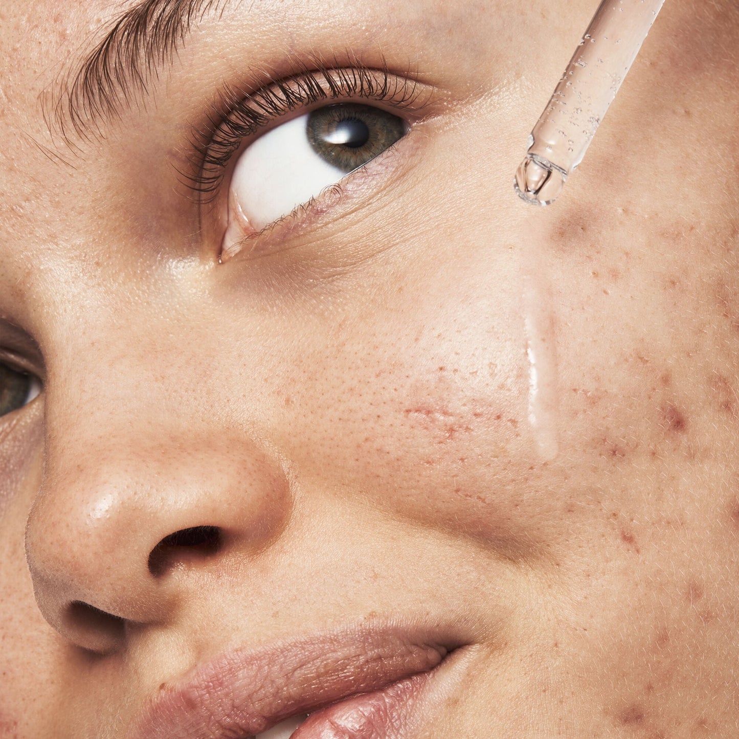 blemish-breakthrough-triple-acid-resurfacing-serum-c2 121321_Marley-Acne-Regimen_0254_FINAL_IGF.jpg