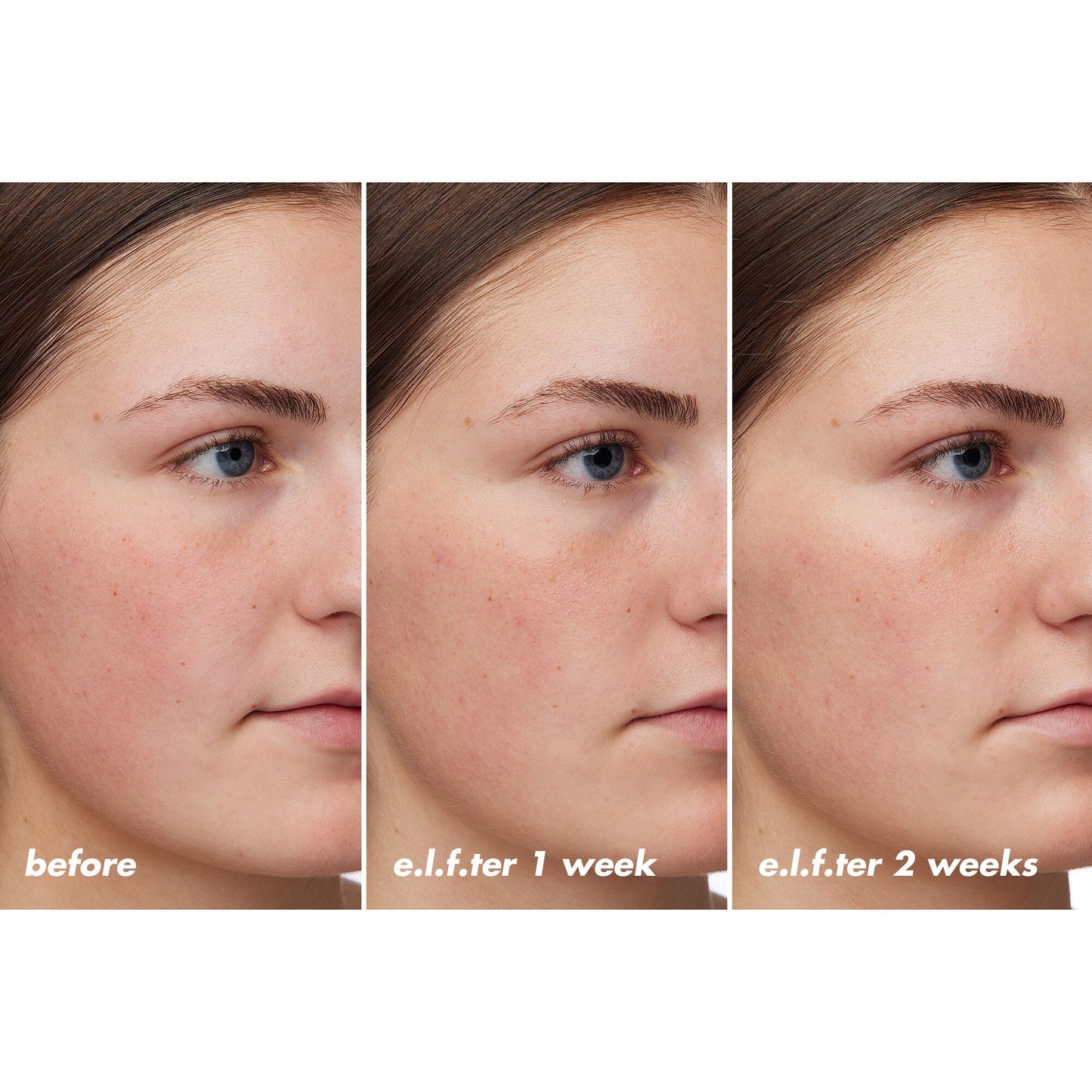 holy-hydration-barrier-goals-cream-regular-v9 XX26_EDUCATION_HH-BarrierGoals_B_A_Zoe_TRYPTICH_74c905bd-67bd-4b91-b633-2b01a8905cb8.jpg
